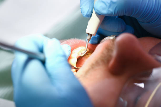 Best Urgent Tooth Repair  in Whitehall, WI
